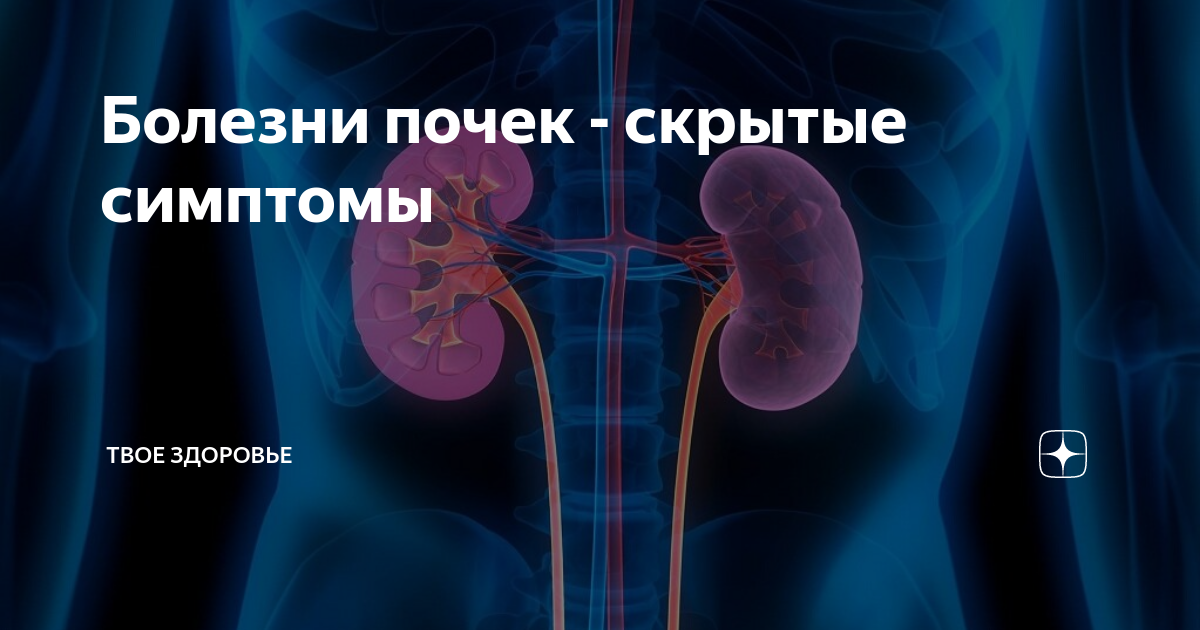 Признаки болезни почек. Болит поясница справа. Болит почка с левой стороны что. Болит почка с левой стороны что. Боль в пояснице.