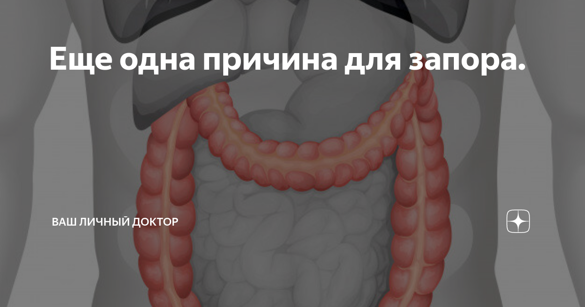 Опущение живота у женщин. Птоз поперечно ободочной кишки рентген. Колоптоз поперечно-ободочной кишки. Опущение органов брюшной полости. Дисплазия соединительной ткани лекарства.