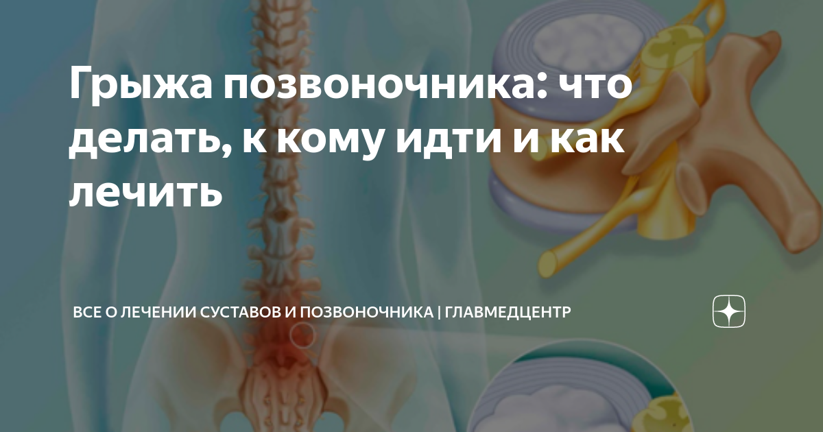 Грыжа позвоночника: что делать, к кому идти и как лечить ...