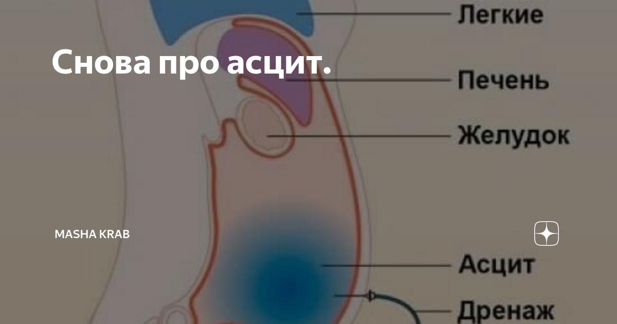 Схема лечения асцита у собак