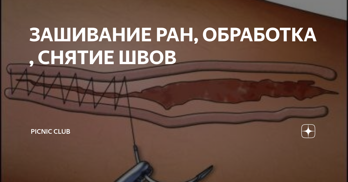 Доктор Первова Описание ПОВ-операций