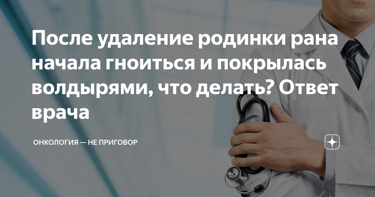 После удаления родинки: ограничения, уход, этапы заживления и возможные последствия