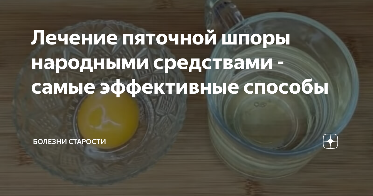 Лечение пяточной шпоры народными средствами самые эффективные