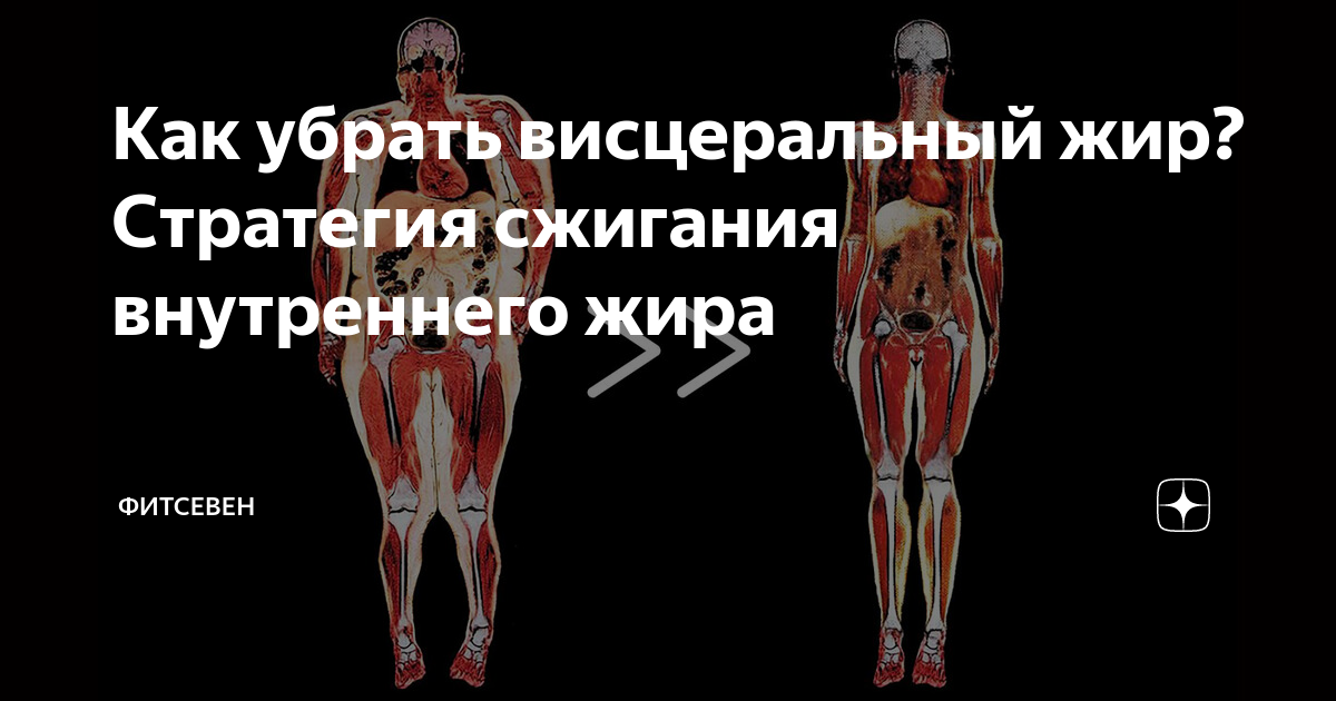 Внутренний жир. Сжигание внутреннего жира. Упражнения от висцерального жира. Сжигание висцерального жира. Сжигатели висцерального жира.