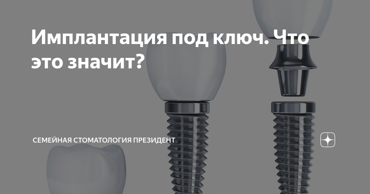 Имплантация под ключ. Имплант под ключ. Имплантация под ключ что это значит. Индивидуальная ложка под импланты. Имплантация под ключ воронеж