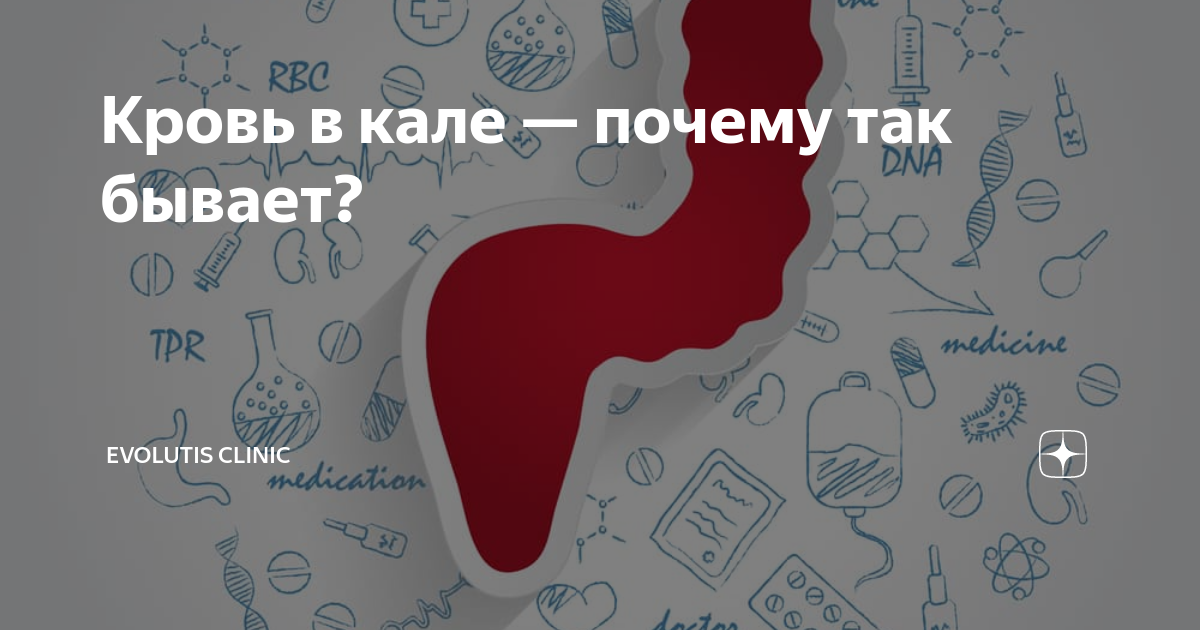 Красные какашки причины. Алая кровь на туалетной бумаге. Алая кровь при дефекации. Кровь на бумаге после дефекации.