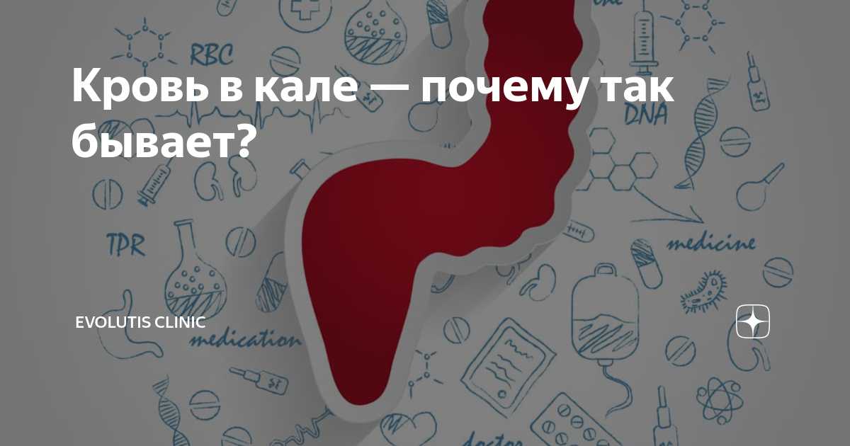 Ярко красная алая кровь. Алая кровь на туалетной бумаге. Алая кровь в стуле причины.