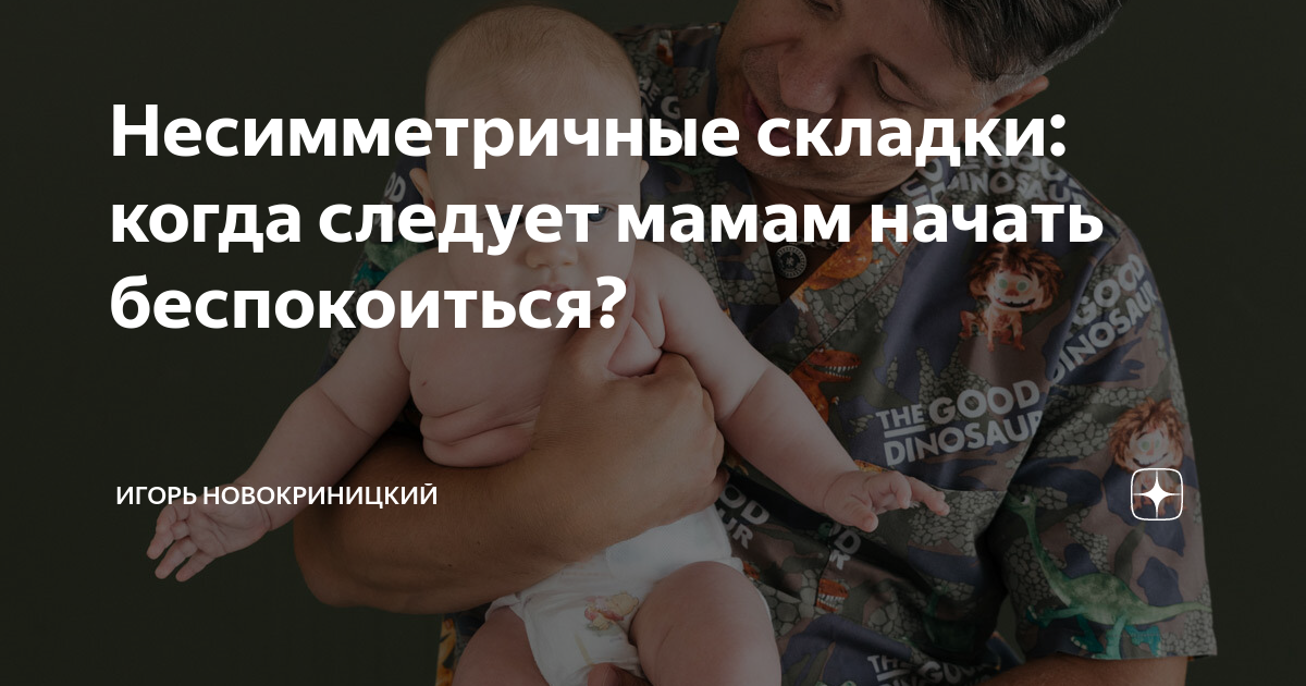 Асимметрии складок. Несимметричные складочки. Складочки на ножках несимметричные. Несимметричные складки на ногах новорожденного. Несимметричные складки на ногах