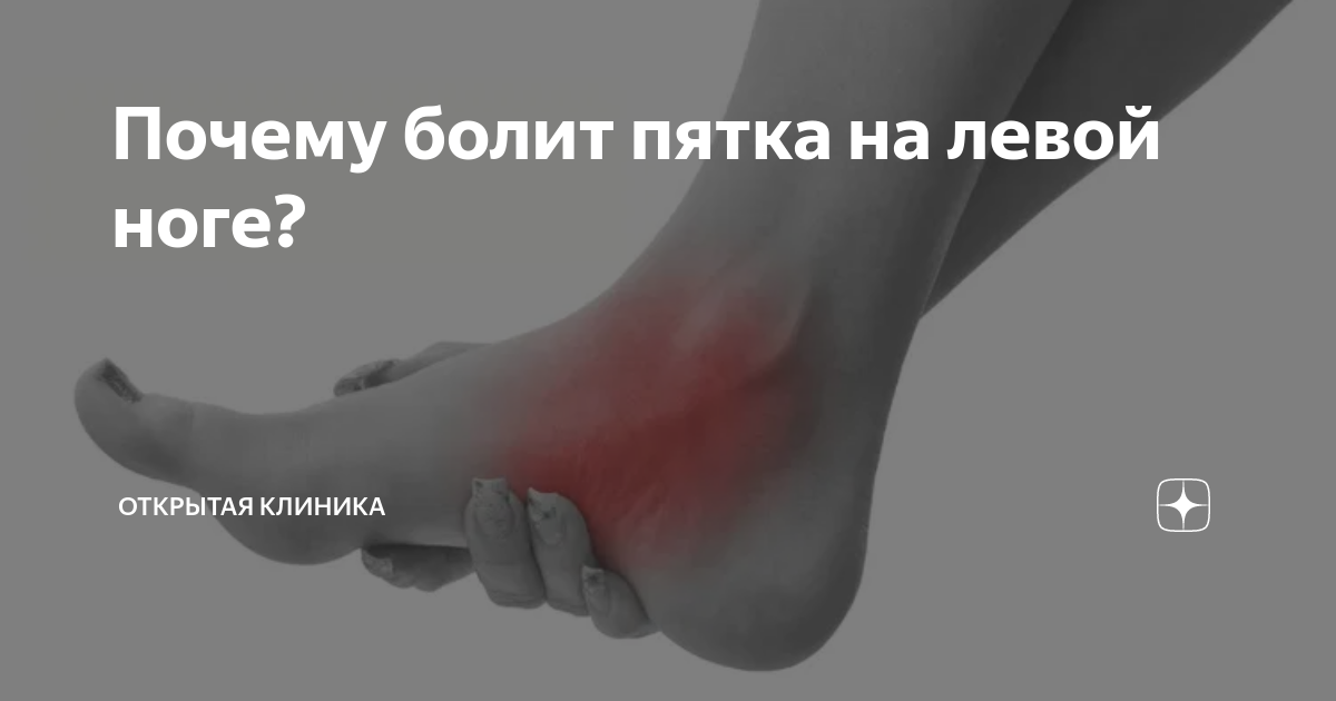 Болит левая пятка причины. Почему болит пятка на левой. Пятка болит причины у женщин. При ходьбе болит пятка левой ноги.