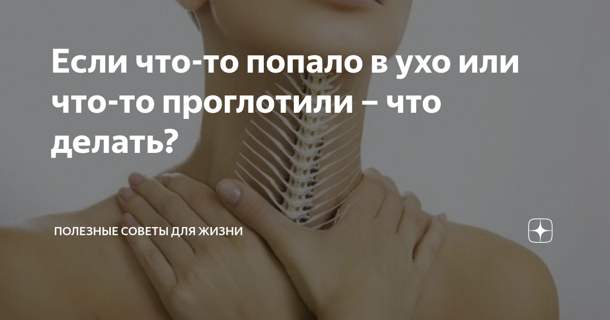 Подавился костью. Если Рыбная кость застряла в горле. Застряла косточка от рыбы в горле. Рыбная косточка застряла в горле.
