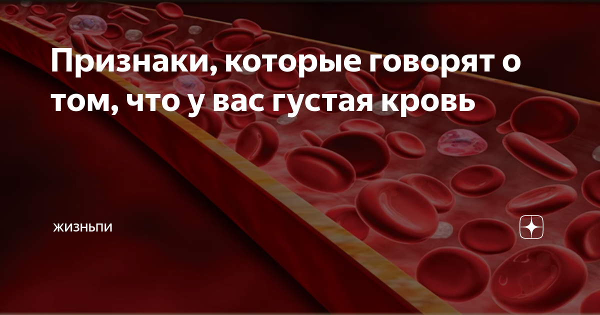 Кровью у взрослого мужчины. Густая кровь причины у женщин.