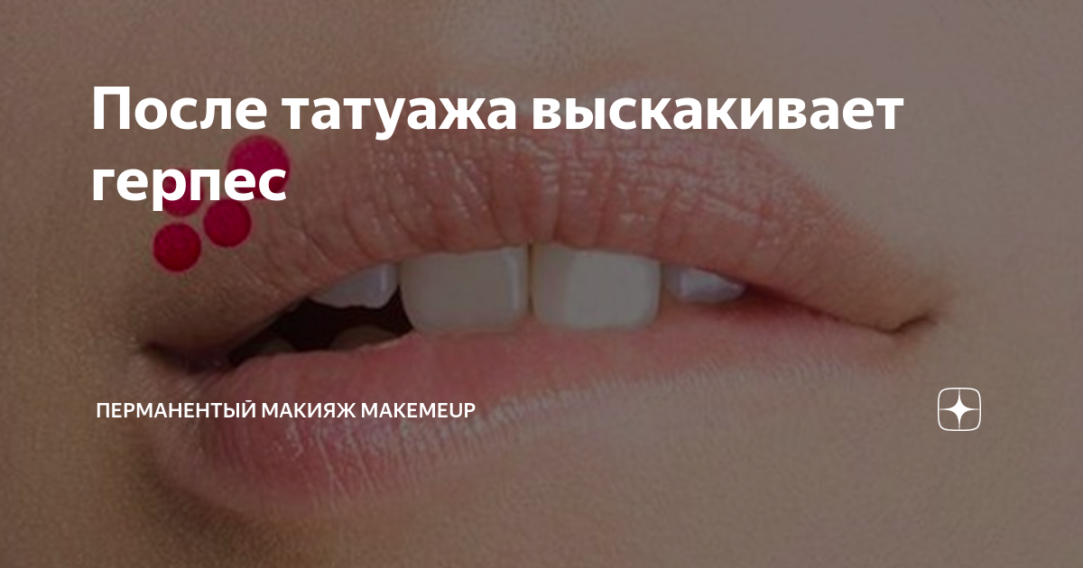 Как пить ацикловир перед татуажем губ схема