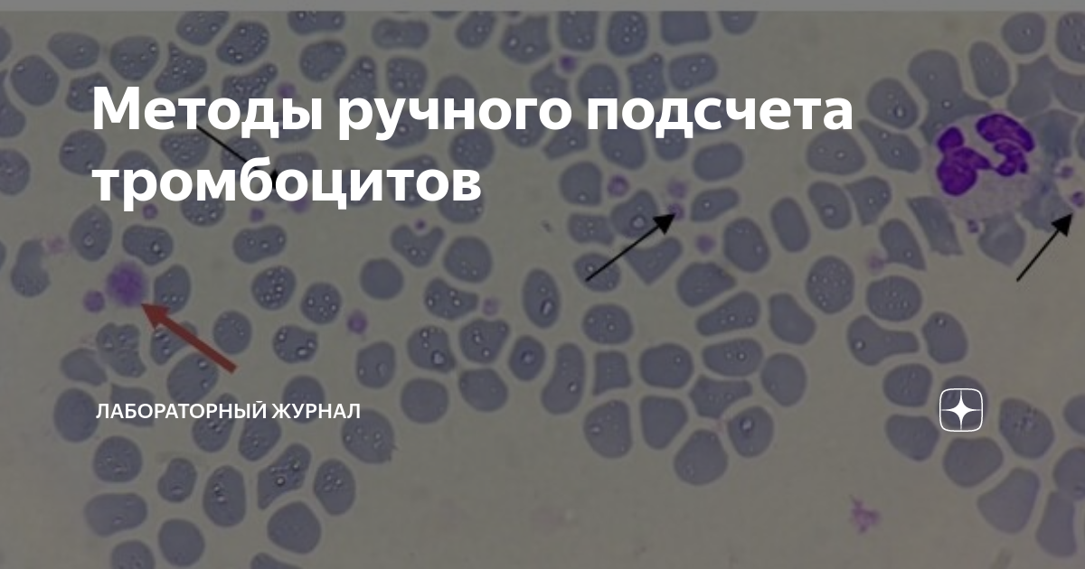 Методы ручного подсчета тромбоцитов | Лабораторный журнал | Дзен