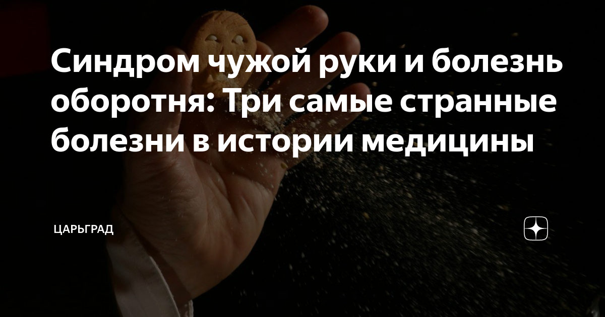 Синдром чужой руки и болезнь оборотня: Три самые странные болезни в ...