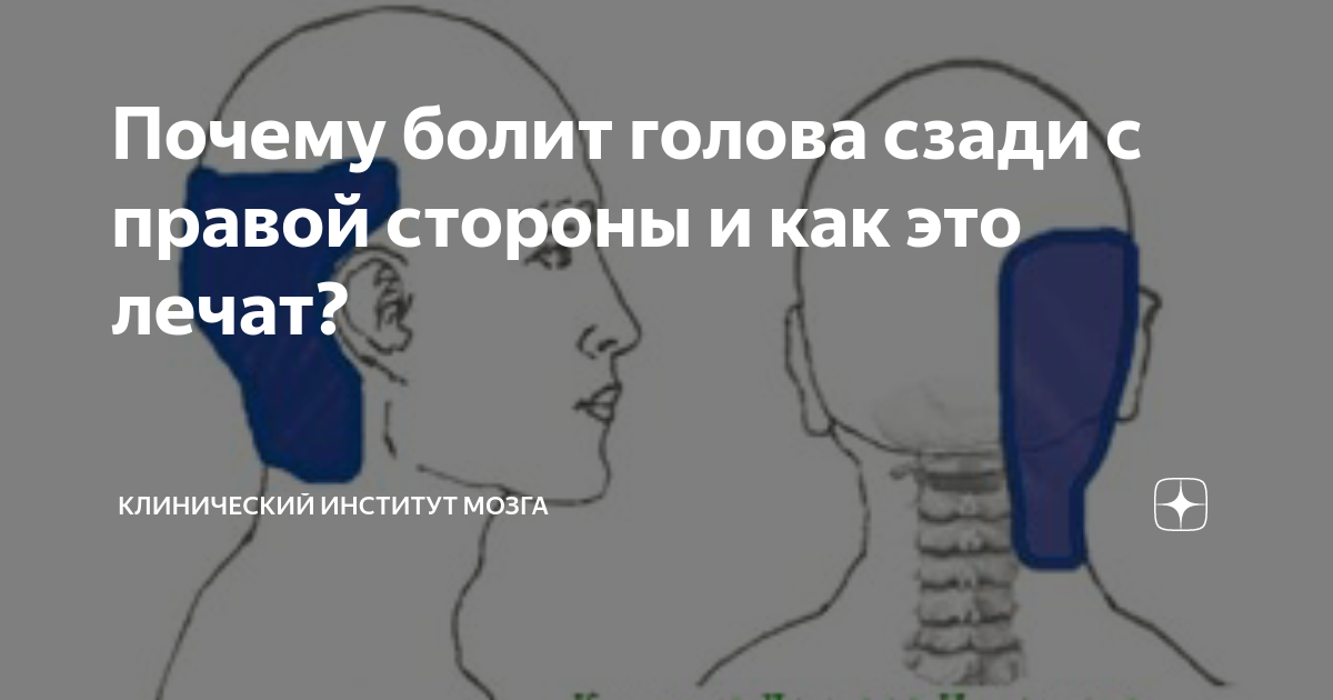 Болит затылок головы причины