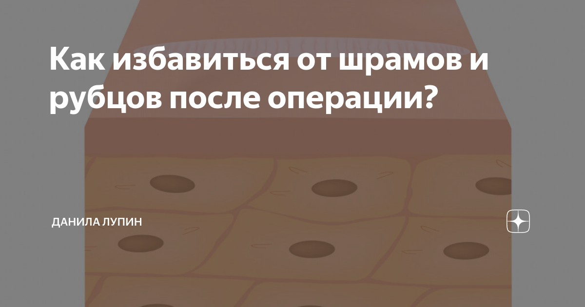 Как избавиться от шрамов и рубцов после операции? | Все о пластической ...