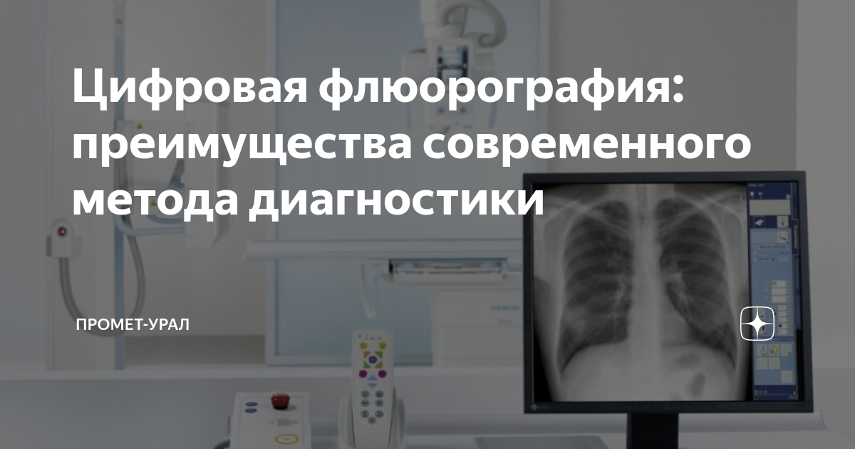 Цифровая флюорография: преимущества современного метода диагностики ...