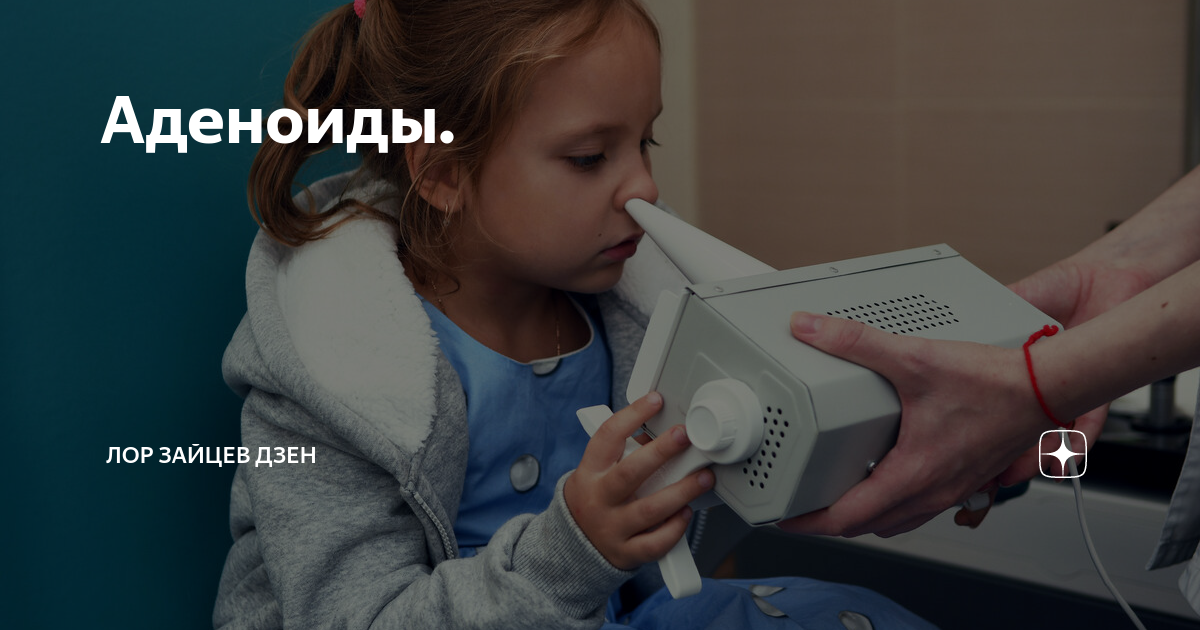 Аденоиды. | ЛОР КЛИНИКА ЗАЙЦЕВА | Дзен