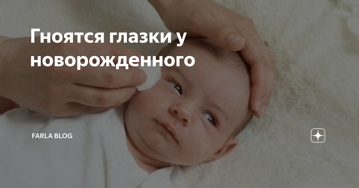 Советы по правильной гигиене глаз у новорожденного ребёнка