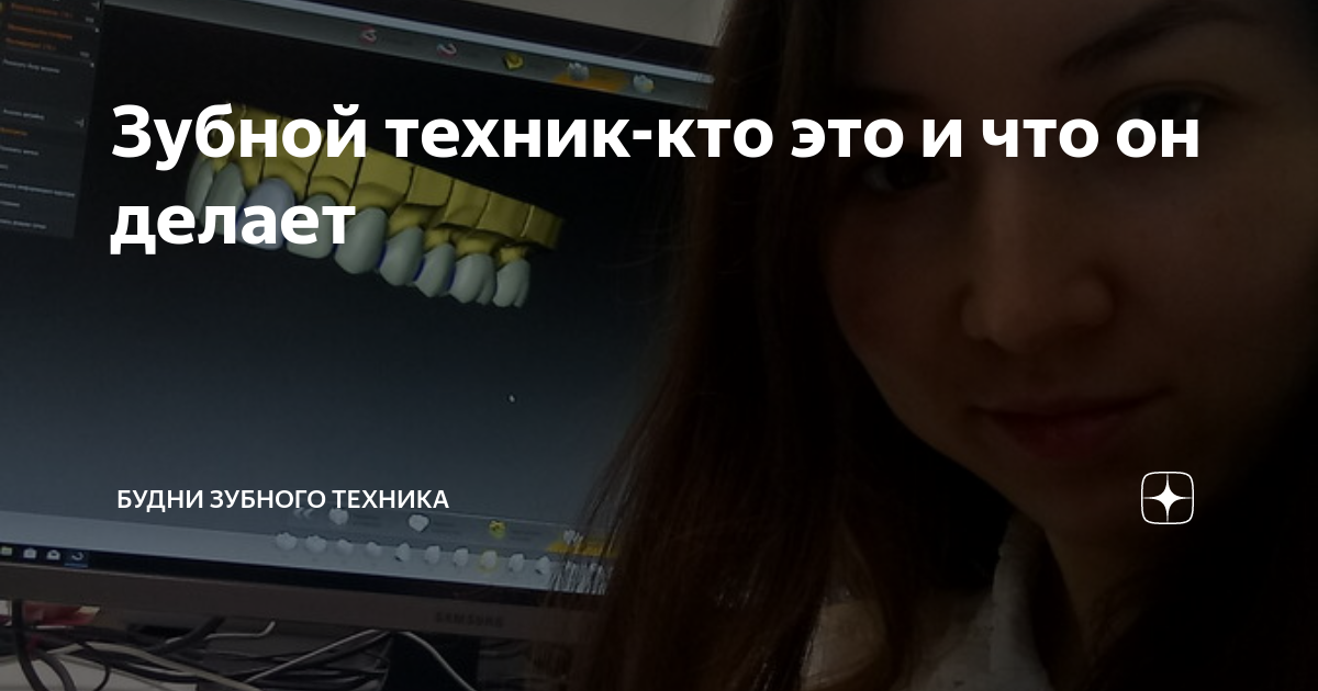 Зубной техник-кто это и что он делает | Будни зубного техника | Дзен