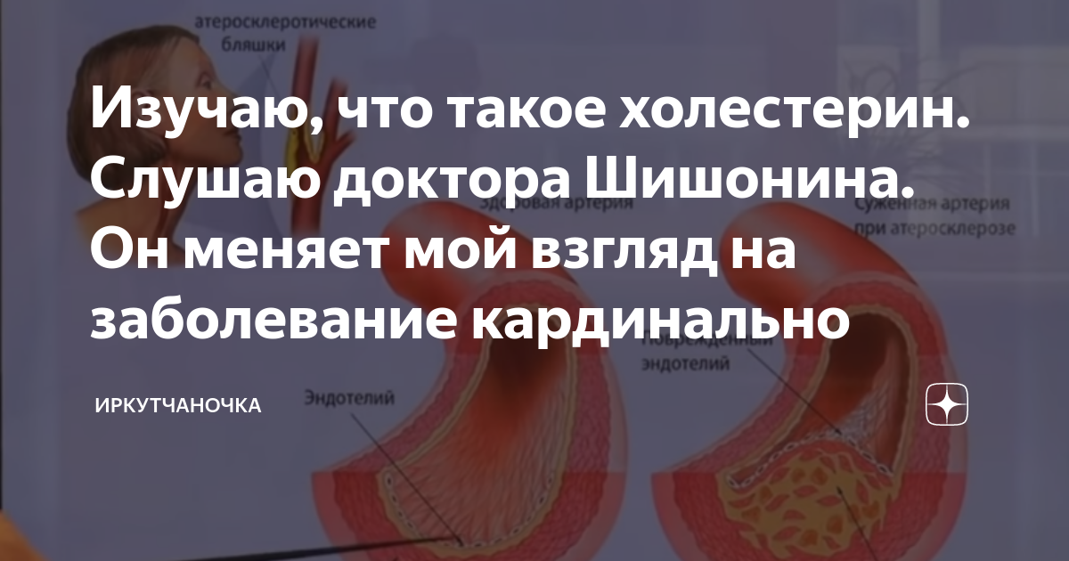 Шишонин бывшие гипертоники. Доктор Шишонин о холестерине. Шишонин атеросклероз. Шишонин холестериновые мифы. Доктор Шишонин нормы холестерина.