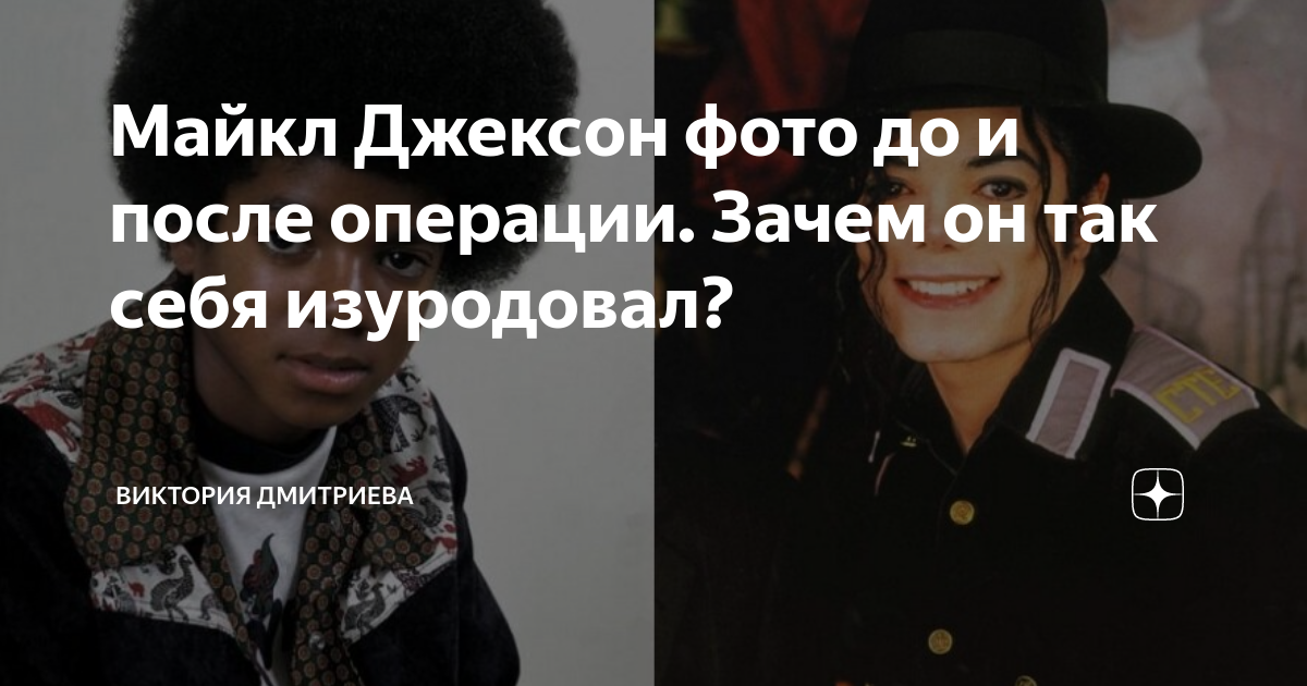 Майл джексон до и после операции Майкл Джексон: Биография