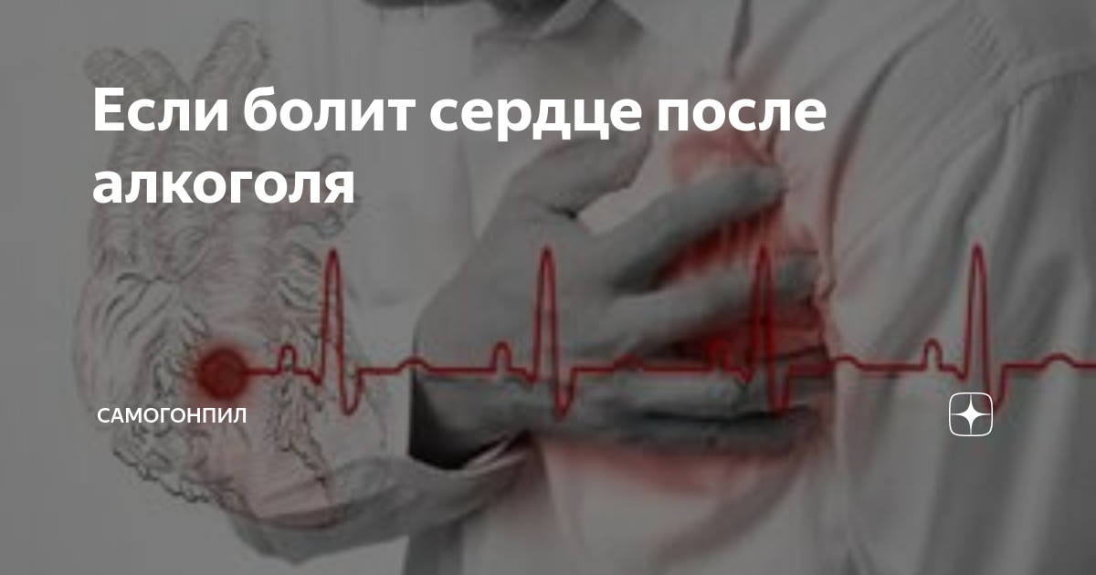 Алкогольная кардиомиопатия: признаки и лечение - MEDСЕМЬЯ