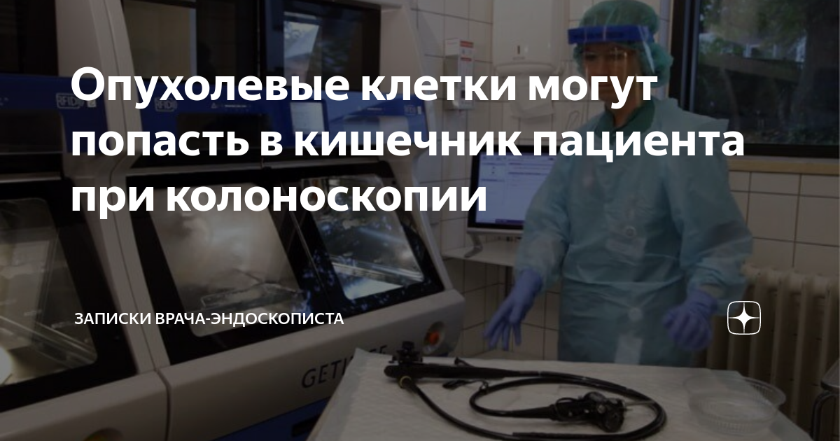 Сеченова колоноскопия