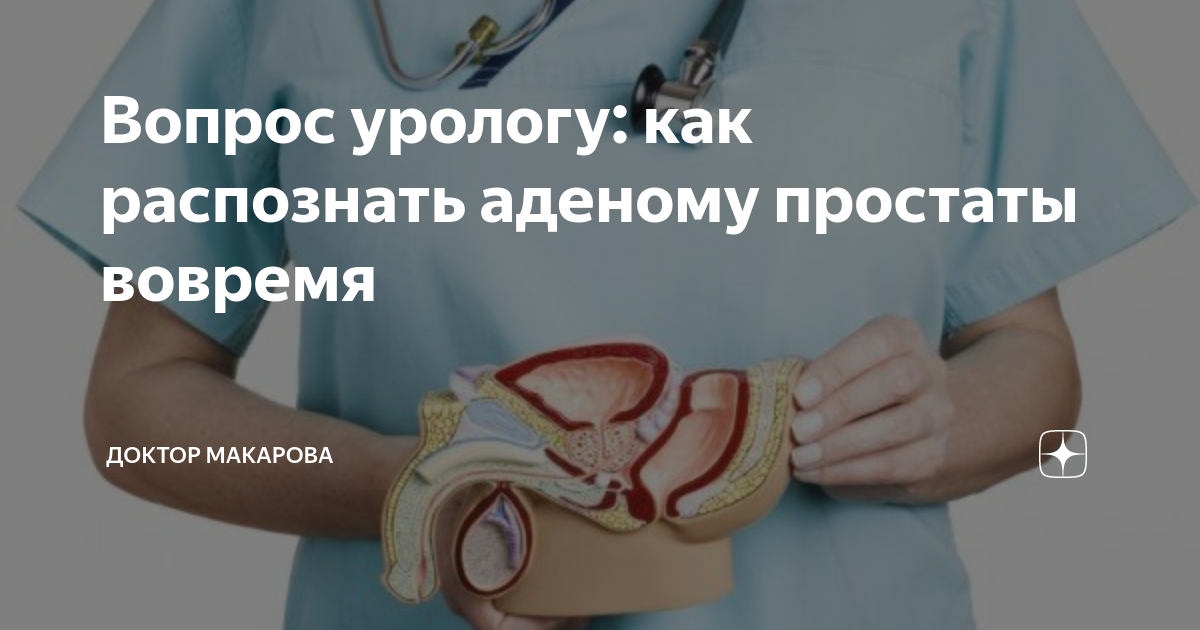 Вопрос урологу: как распознать аденому простаты вовремя | Доктор ...