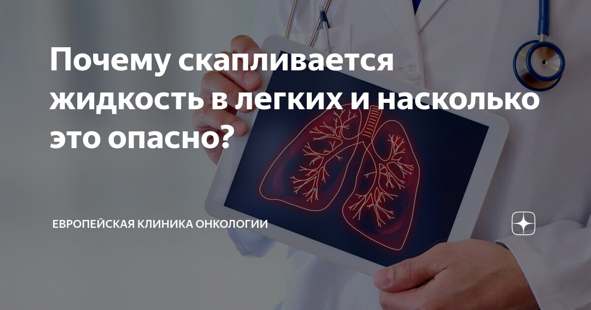 как называется болезнь жидкость в легких