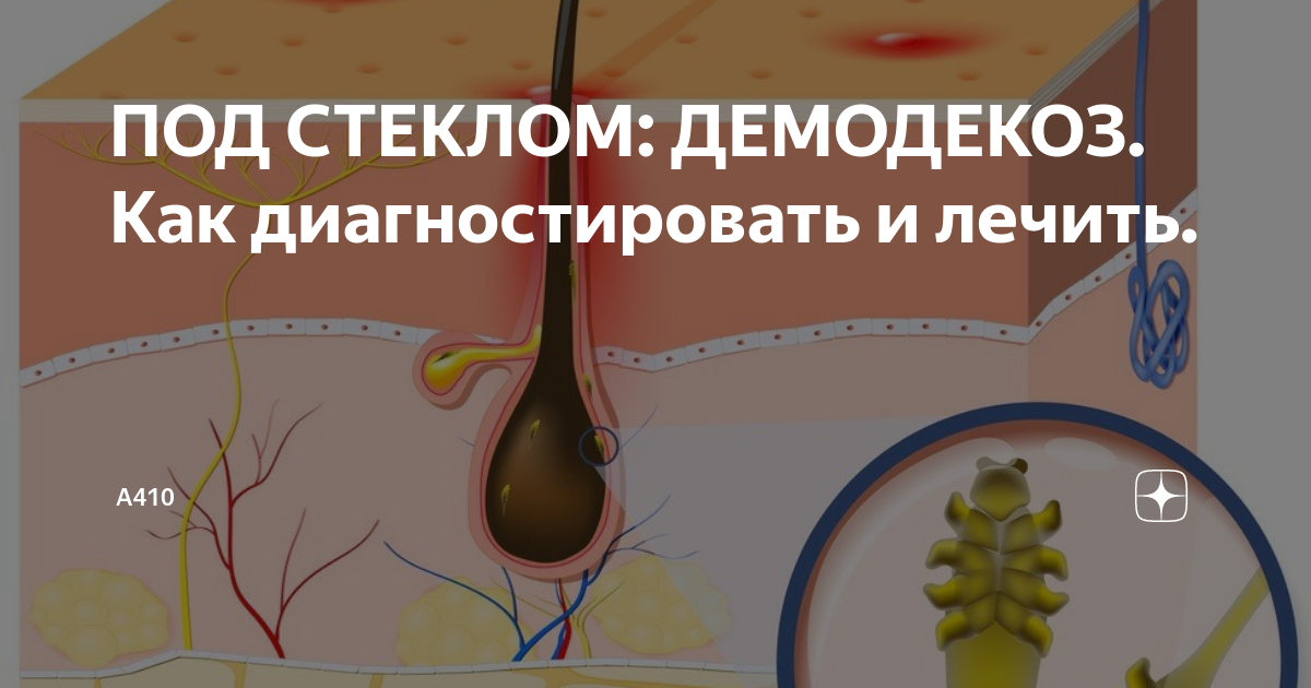 ПОД СТЕКЛОМ: ДЕМОДЕКОЗ. Как диагностировать и лечить. | А410 | Дзен