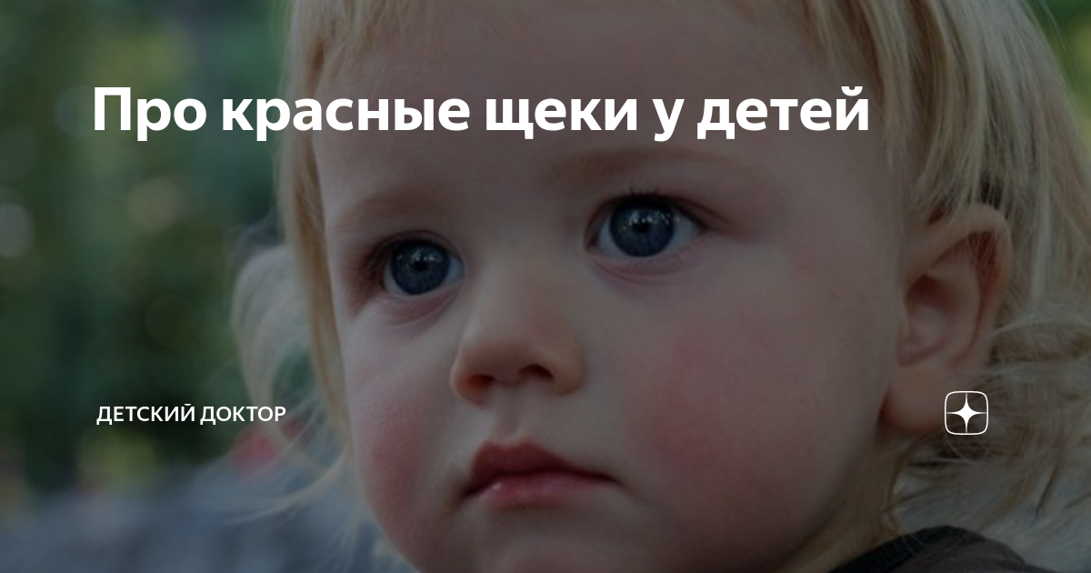 Красные щеки и подбородок. — 14 ответов | форум Babyblog