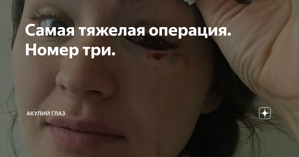 Самая тяжелая операция. Номер три. | Акулий глаз | Дзен