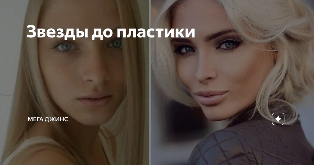 Звезды до пластики | Мега Джинс | Дзен