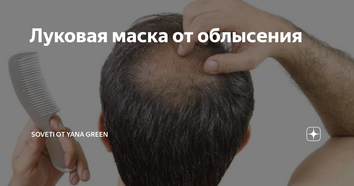 Toppik загуститель волос 55гр. Tiande шампунь master herb от облысения. мастер херб шампунь от облысения. тианде шампунь от облысения. озонотерапия волос до и после.