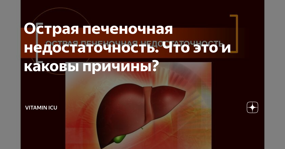 Острая печеночная недостаточность. Что это и каковы причины? | Vitamin ...