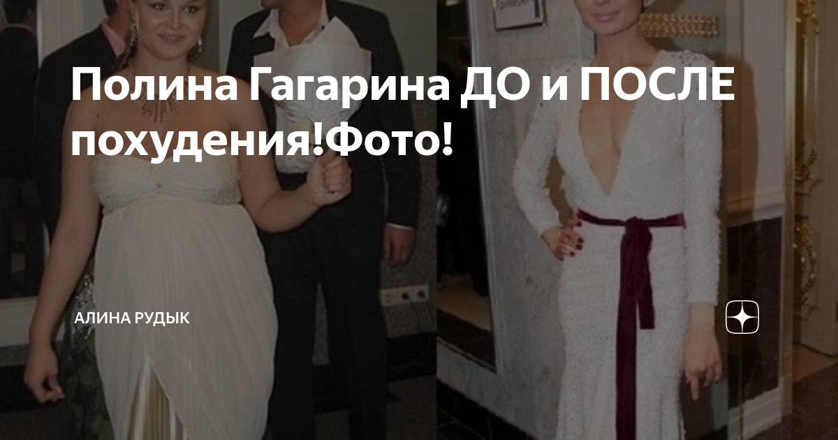 Полина Гагарина ДО и ПОСЛЕ похудения!Фото!