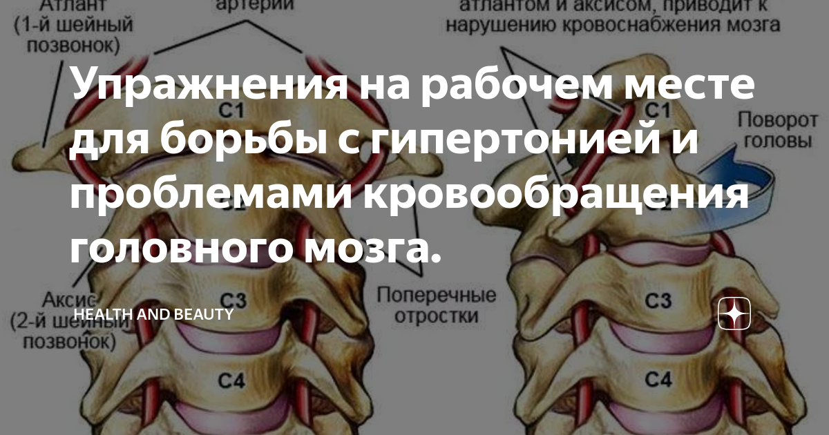 Смещение позвонка упражнения. Упражнения для кровообращения мозга. Упражнения для улучшения кровообращения головного мозга. Упражнения для кровотока в мозг. Зарядка при нарушении кровообращения головного мозга.