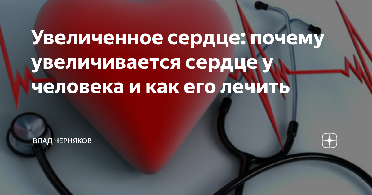 Увеличенное сердце: почему увеличивается сердце у человека и как его лечить