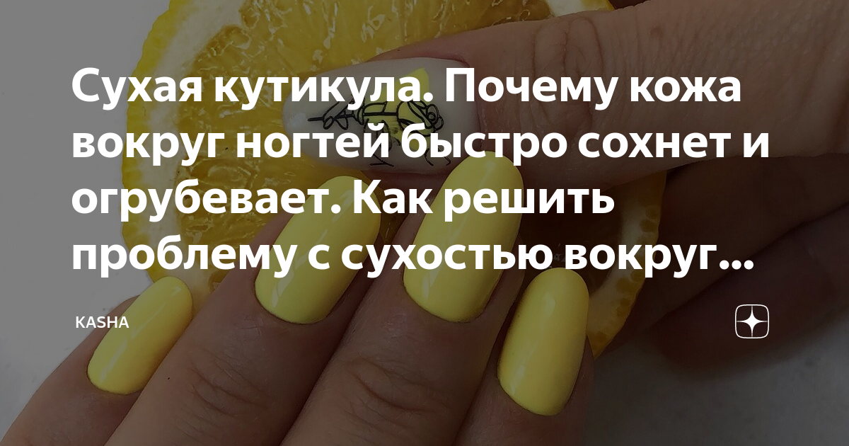 Сухая кутикула и кожа вокруг ногтей: что делать | Бархатные Ручки