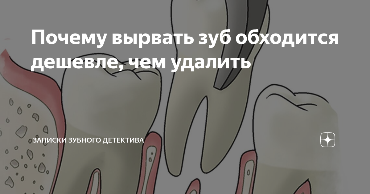 Первая помощь при пищевом отравлении. Зачем вырывает. Зачем вырывает. Рвота при отравлении. Приступ рвоты.