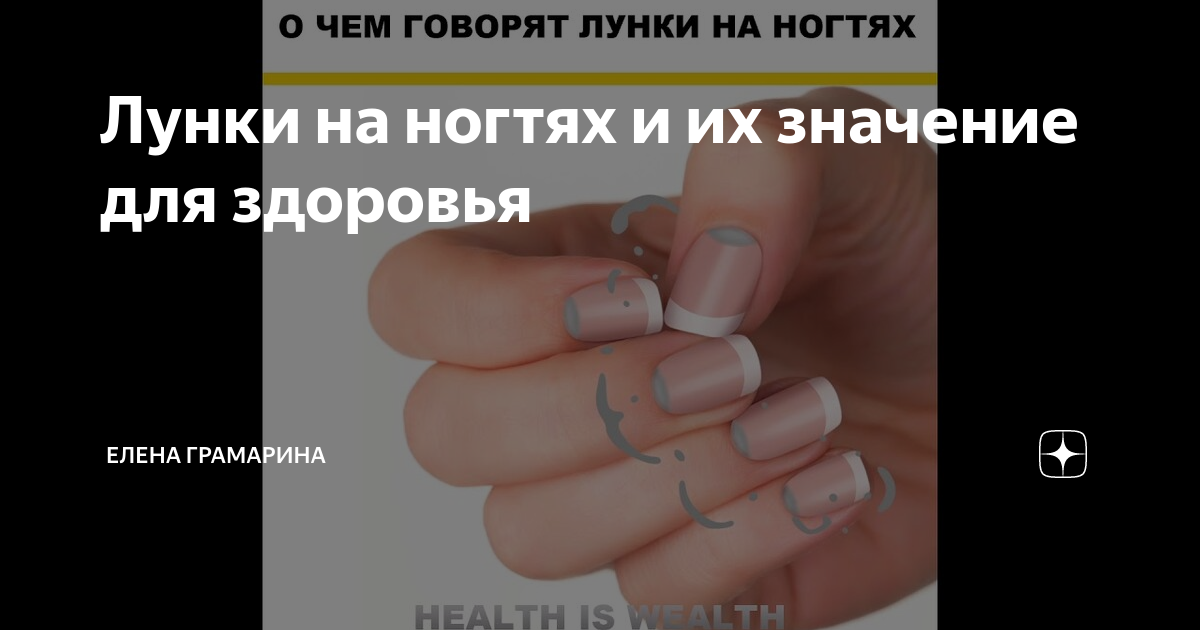 Трещины на ногтях и желтизна - что означают, советы эксперта | Новости РБК Украина