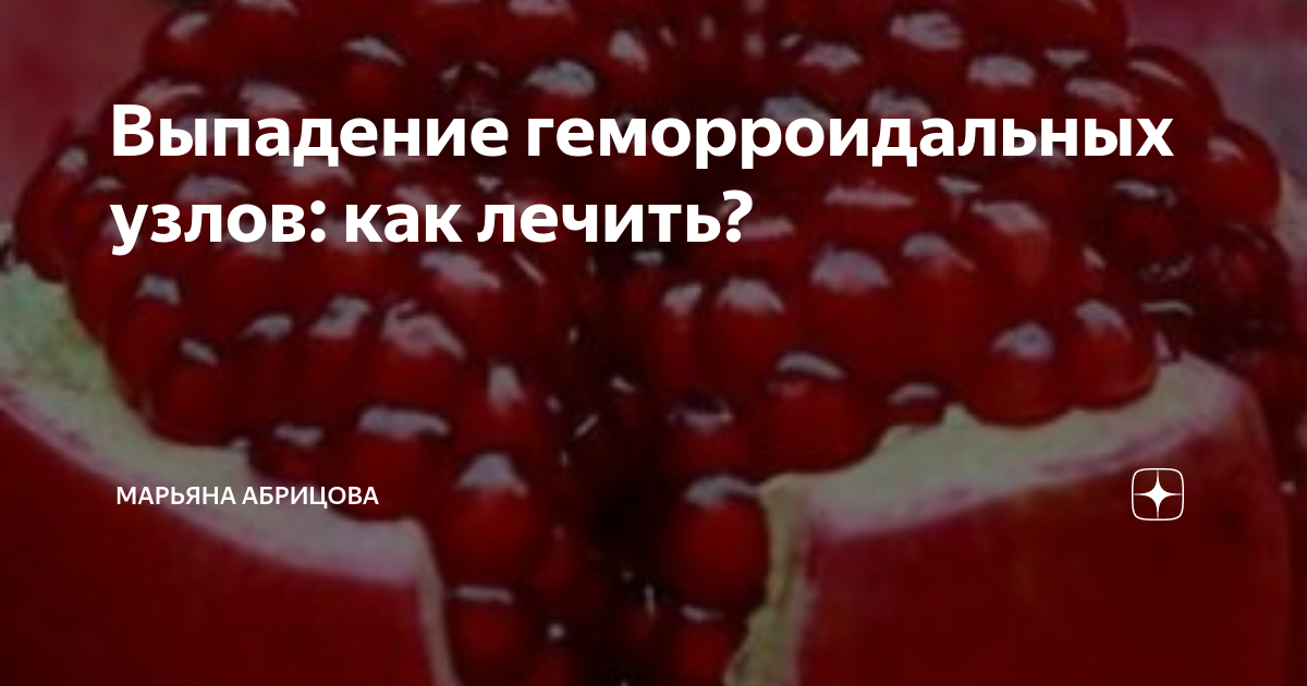 Выпадение геморроидальных узлов: как лечить? | Марьяна Абрицова | Дзен
