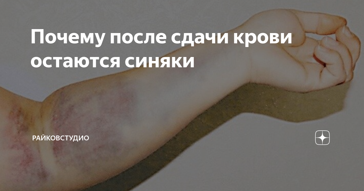 что будет если не спать перед сдачей крови из вены