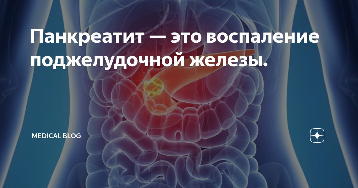 Снятие воспаления поджелудочной. Воспаление поджелудочной. Воспаление поджелудочной железы на латинском. Воспаление поджелудочной воспаление кишечника лечение.