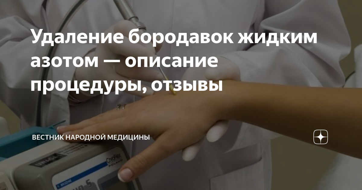 Чем лучше удалять новообразования: лазером или жидким азотом