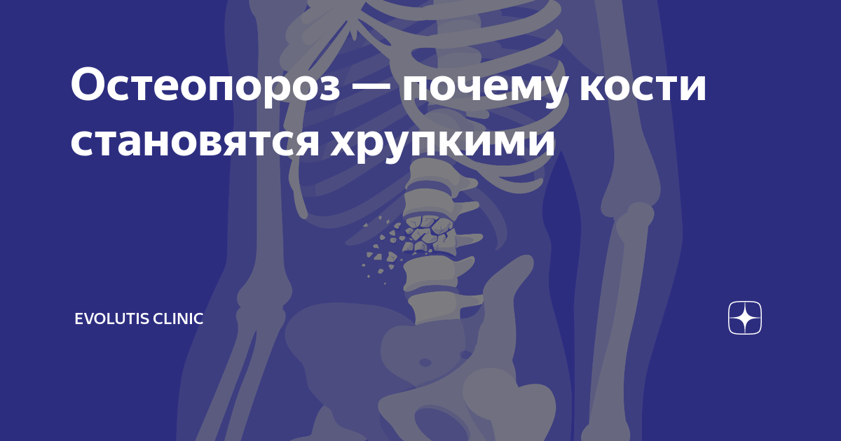 Профилактика остеопороза при помощи лечебной минеральной воды