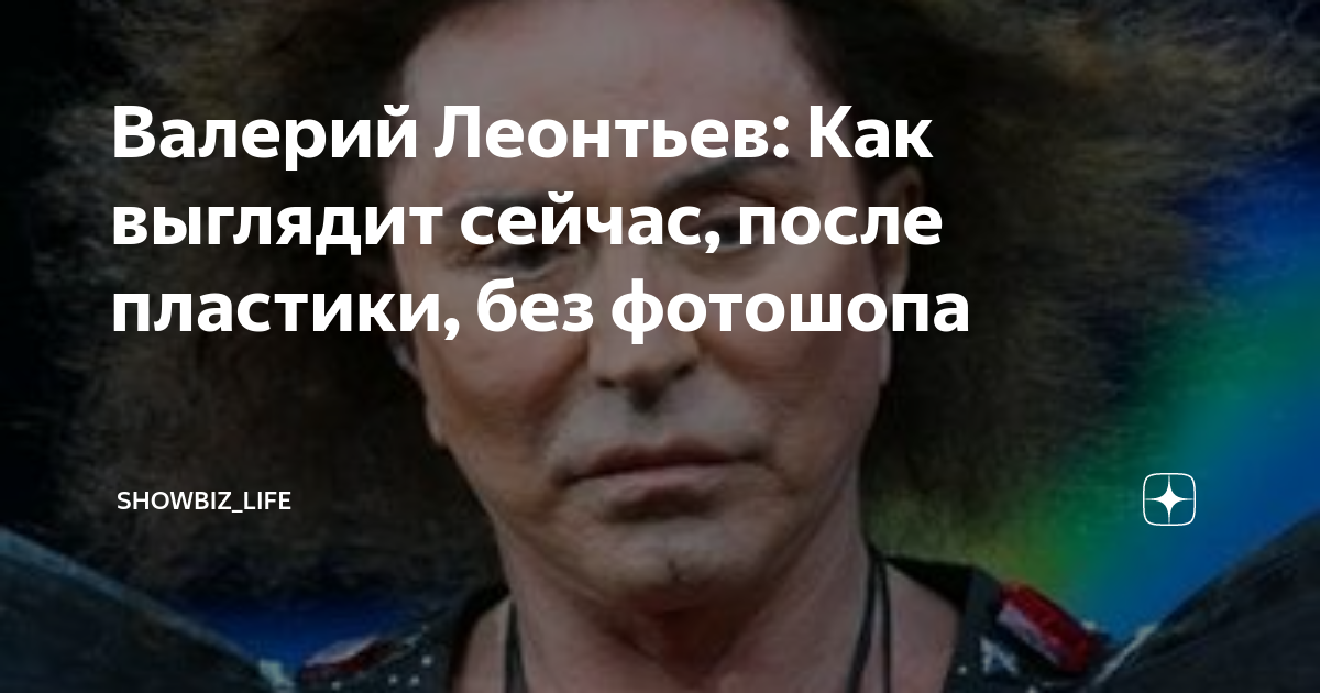 Валерий Леонтьев: Как выглядит сейчас, после пластики, без фотошопа ...