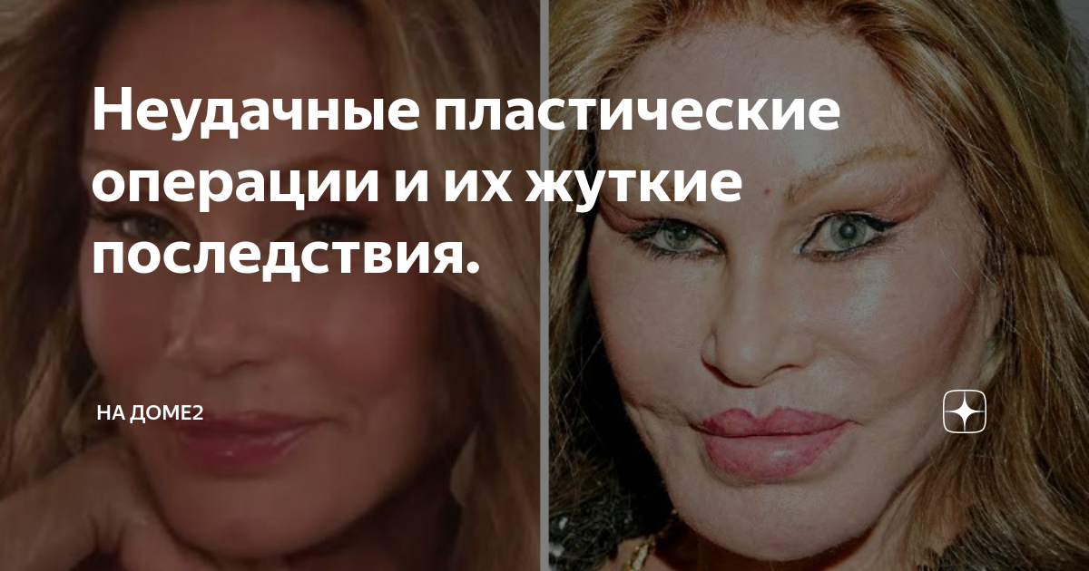 неудачная пластика зудиной