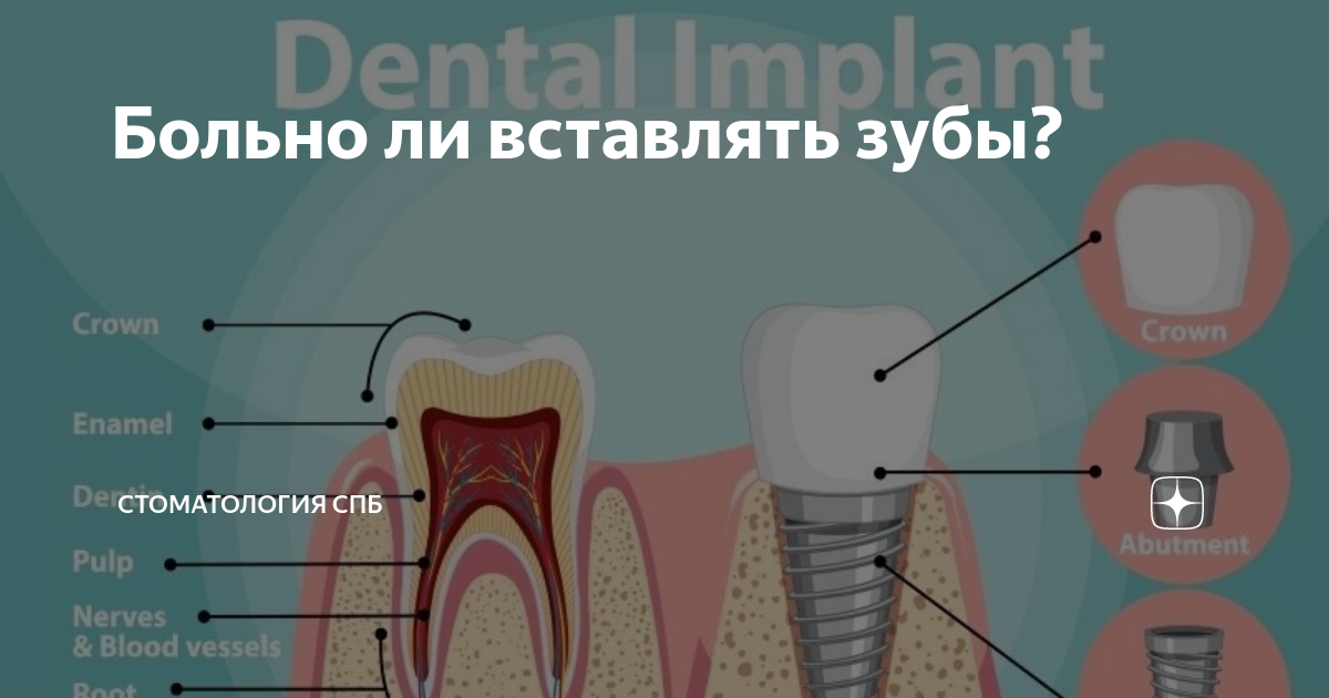 Вставить зуб курск